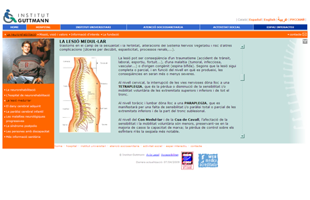LEsionMedular.png